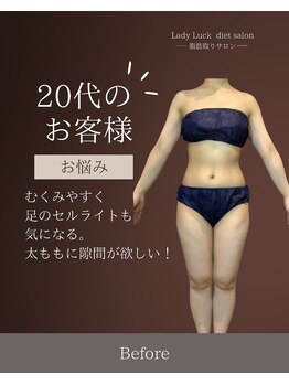 レディラック 大阪梅田本店(Lady Luck)/マイクロウェーブリフトコース