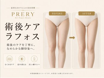 プレリー 自由が丘店/術後のむくみ