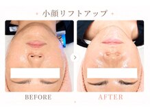 パールプラス 日立店(Pearl plus)/小顔リフトアップも叶う