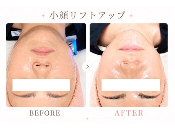 パールプラス 日立店(Pearl plus)/小顔リフトアップも叶う