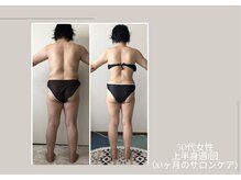 ビューティーサロン アール(R)/痩身マシーン上半身