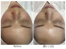 ビボーラ(BEBEAURA)/☆潤いフェイシャル☆