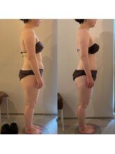 ラナ 京都西院店(Lana)/全身むくみ解消・姿勢改善！