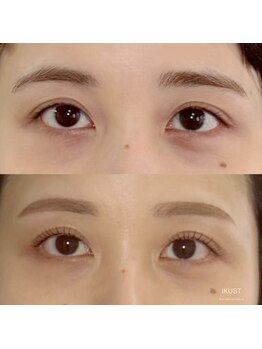 イクスト 吉祥寺(IKUST)/【眉毛/眉毛WAX/眉/アイブロウ】