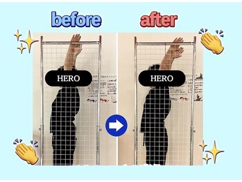 ストレッチヒーロー 加古川店/肩の可動域上がります!