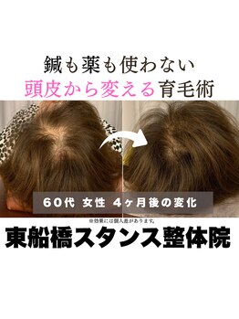 東船橋スタンス整体院の写真/毛髪診断士が行う育毛特化の頭皮環境改善術｜巡りが変わりボリュームアップで鏡を見るのも楽しくなる◎