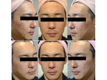 サロン リノ(SALON Lino)/ビフォーアフター