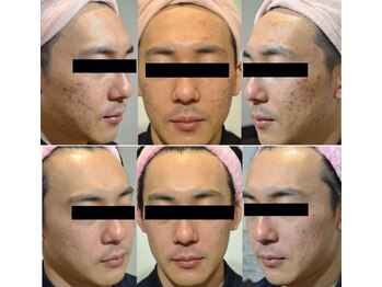 サロン リノ(SALON Lino)/ビフォーアフター