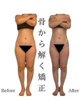 エミナル(EMINALu)/太腿のハリ／ぽっこりお腹