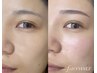 【垢抜け顔に】似合わせ美眉　アイブロウWAX + 顔脱毛 フルフェイス★7700円