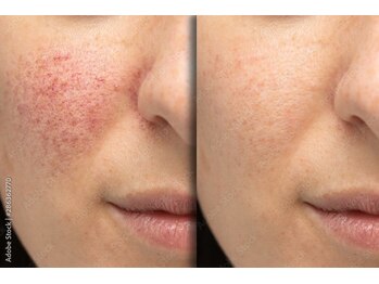 プレステージア(PRESTIGEA)/サロンイメージ