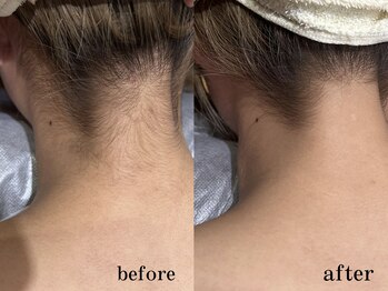 フィノアンド(feino&...)/【エステメニュー】