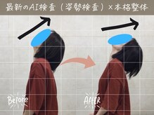 ナオル整体 町田院(NAORU整体)/before/after【8】 町田/整体