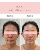 シンナリ(Shinnari)/カスタム小顔×美肌フェイシャル