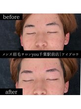 ユー 千葉駅前店(you)/ビフォ－アフター写真