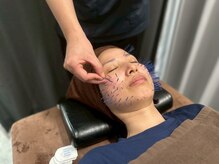 はまの整骨鍼灸院の雰囲気(国家資格者による美容鍼でフェイスライン・肌質改善◎)