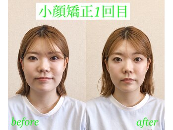 オズ六本木の写真/気持ち良い小顔矯正で理想の小顔へ。眠ってしまうほどのソフトな施術で笑顔も輝く♪
