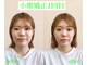 オズ六本木の写真/気持ち良い小顔矯正で理想の小顔へ。眠ってしまうほどのソフトな施術で笑顔も輝く♪