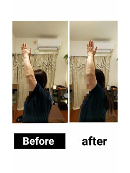 アース エンジェル整体院/ビフォアフ 肩こり ストレッチ