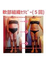 ビューティサロン キヨの部屋(beauty salon)/【軟部組織セラピー】週１回×５