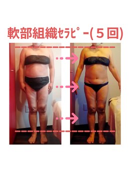 ビューティサロン キヨの部屋(beauty salon)/【軟部組織セラピー】週１回×５