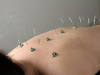 ハリサロンドオフ 西梅田店(hari salon de off)の写真/【女性のお悩み専門鍼灸院♪】慢性的なお体の不調をサポート！心地良いプライベート空間でリラックス◎