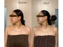 ヴィアージュ(Viage)/ブライダルコルギ