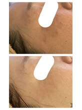 エクシア(ECXIA)/モヤモヤもお任せください