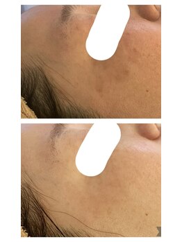 エクシア(ECXIA)/モヤモヤもお任せください