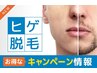メンズ脱毛★新規限定★おヒゲ脱毛★通常1回5,999円→なんと！！3回9,999円