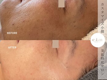 エイム(e.i.m)/40代：くすみ/肌荒れ