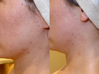 サロン ド ブラン アオヤマ(Salon de BLANC AOYAMA)/