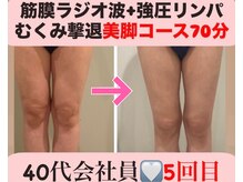 マール(Mar)/ビフォーアフター痩身/骨格矯正