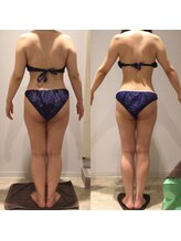 アユアランリンク 錦糸町店/I様：背面