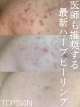 トップスキン 表参道(TOPSKIN) 専門店だか らできる技