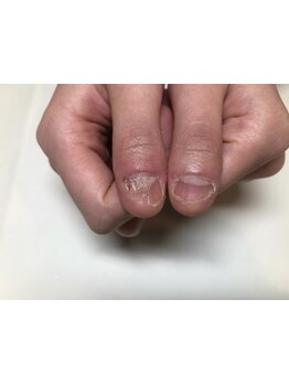 爪の悩みを解消できる（ケア含む）