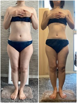 ハレアンド(Hare&)/40代全身痩身15回目