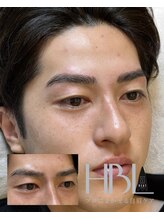 ユマニ バイ ヒート(Humani by HEAT)/