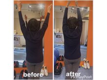 カワル整体 上通り院/夜にうずく肩の痛みでお悩みの方