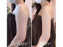 ブリランテ(Brillante)の雰囲気（二の腕がこんなにスッキリ！確実な技術で見た目を劇的に変えます）