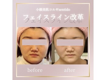 小顔美肌コルギ専門店 センティード 吉祥寺(Sentido)/