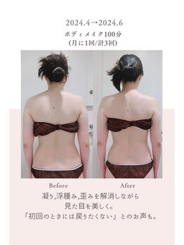 トゥインクル 麻布(twinkle)/南麻布/勝山式美容矯正/小顔矯正