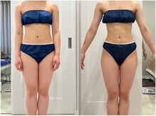 シルク ド ココ(Silk de Coco)/セルクリア