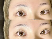 シエンテ(Ciente)/左右差瞼さん