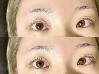 シエンテ(Ciente)/左右差瞼さん