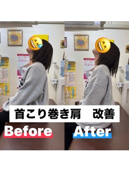 ヒデ整体院(Hide整体院)/猫背矯正骨盤矯正B/A肩こり腰痛