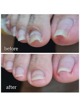 爪切り屋 足楽/