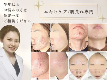 ビューティーホリック 蘇我店(BEAUTY HOLIC)