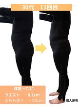 ヨサパーク ユア(YOSAPARK Yua)/11回目の施術結果