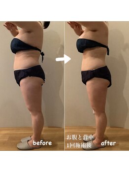 ルーシー(Lucy)/フォースカッター 90分